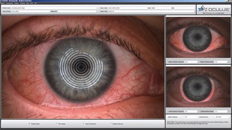 tear free clinical ocular testing|oculus eye diagnosis.